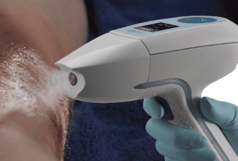 Ultra Mist Therapy