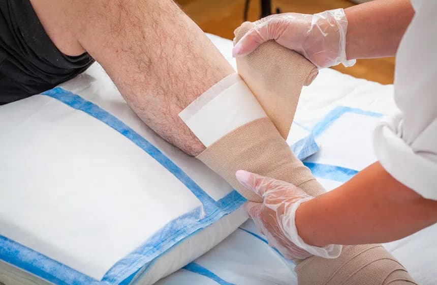 Arterial Ulcers